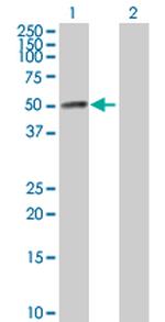 HAVCR1 Antibody in Western Blot (WB)