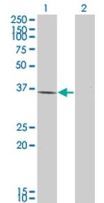 HAVCR1 Antibody in Western Blot (WB)