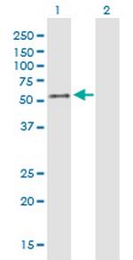 HAVCR1 Antibody in Western Blot (WB)