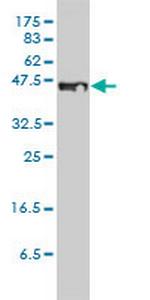 STEAP1 Antibody in Western Blot (WB)