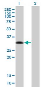 ZBTB32 Antibody in Western Blot (WB)