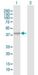 ACAD8 Antibody in Western Blot (WB)