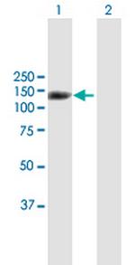 SND1 Antibody in Western Blot (WB)