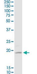 D4S234E Antibody in Western Blot (WB)