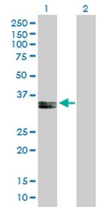 PPA2 Antibody in Western Blot (WB)