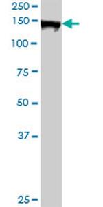 AFF4 Antibody in Western Blot (WB)