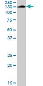 AFF4 Antibody in Western Blot (WB)