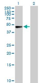 AFF4 Antibody in Western Blot (WB)