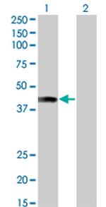 AFF4 Antibody in Western Blot (WB)