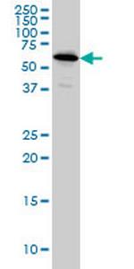 NDOR1 Antibody in Western Blot (WB)