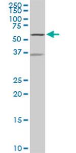 NDOR1 Antibody in Western Blot (WB)