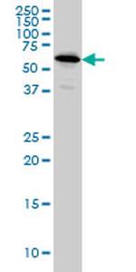 NDOR1 Antibody in Western Blot (WB)