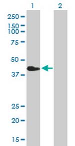 CHIA Antibody in Western Blot (WB)