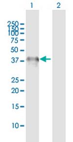 CHIA Antibody in Western Blot (WB)