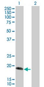 IL17C Antibody in Western Blot (WB)