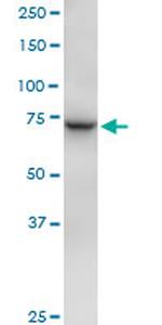 TUBGCP4 Antibody in Western Blot (WB)