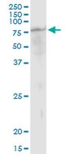 TUBGCP4 Antibody in Western Blot (WB)