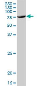 TUBGCP4 Antibody in Western Blot (WB)