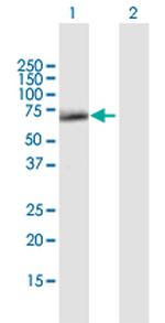 SESN1 Antibody in Western Blot (WB)