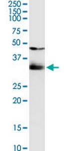 SULT1B1 Antibody in Western Blot (WB)