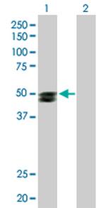 SMPDL3B Antibody in Western Blot (WB)