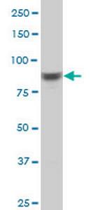 RPS6KA6 Antibody in Western Blot (WB)