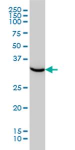 HTRA2 Antibody in Western Blot (WB)