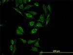 HTRA2 Antibody in Immunocytochemistry (ICC/IF)