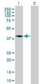 PCLO Antibody in Western Blot (WB)