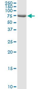 DLL1 Antibody in Western Blot (WB)