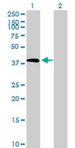 TRIB2 Antibody in Western Blot (WB)