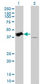 TRIB2 Antibody in Western Blot (WB)