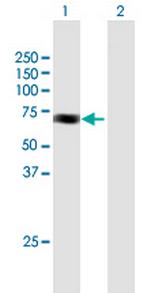 ACAD9 Antibody in Western Blot (WB)