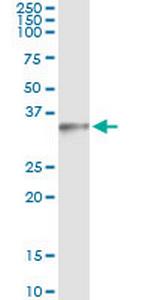 MAGEH1 Antibody in Immunoprecipitation (IP)