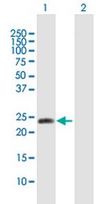 METTL11A Antibody in Western Blot (WB)