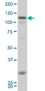 HIPK2 Antibody in Western Blot (WB)