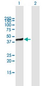 HSPC142 Antibody in Western Blot (WB)