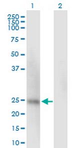 SSU72 Antibody in Western Blot (WB)