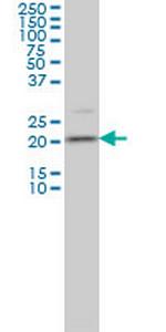 TAGLN3 Antibody in Western Blot (WB)