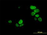 UHRF1 Antibody in Immunocytochemistry (ICC/IF)