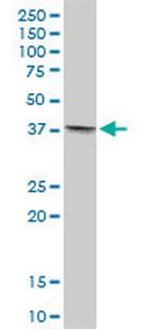 TMOD4 Antibody in Western Blot (WB)