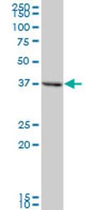 TMOD2 Antibody in Western Blot (WB)