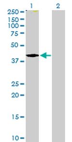 TMOD2 Antibody in Western Blot (WB)