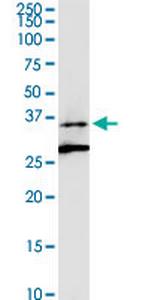 ALG5 Antibody in Western Blot (WB)