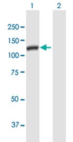 DSE Antibody in Western Blot (WB)