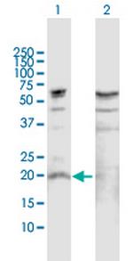 IL19 Antibody in Western Blot (WB)