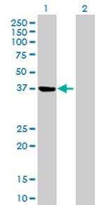 PSAT1 Antibody in Western Blot (WB)