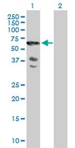 SCHIP1 Antibody in Western Blot (WB)