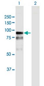 BAZ2B Antibody in Western Blot (WB)