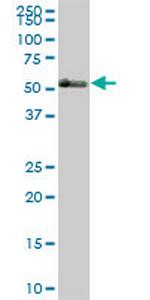 TBX21 Antibody in Western Blot (WB)